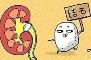 【健康科普】学会健康生活，告别泌尿结石