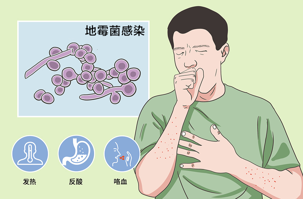 春节将至，清理家中杂物时，谨防霉菌感染！