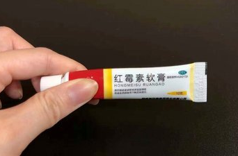 红霉素软膏千万不能随便用！赶紧告诉家里人