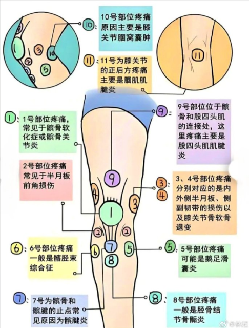 氨糖哪个牌子有效？全网公认氨糖优质品牌推荐，助你安全快速养好关节