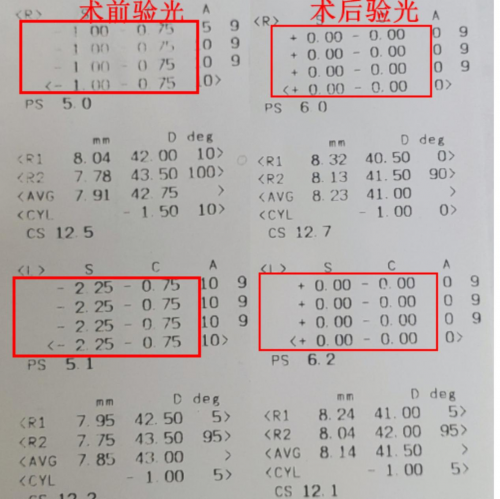 术后验光0度！全飞秒4.0助高考生跨越公安院校视力门槛